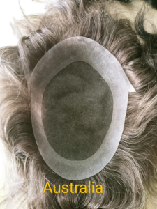 AU