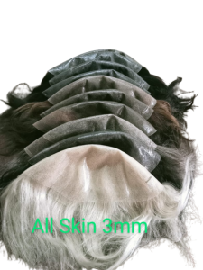 ALL