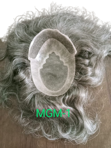 MG